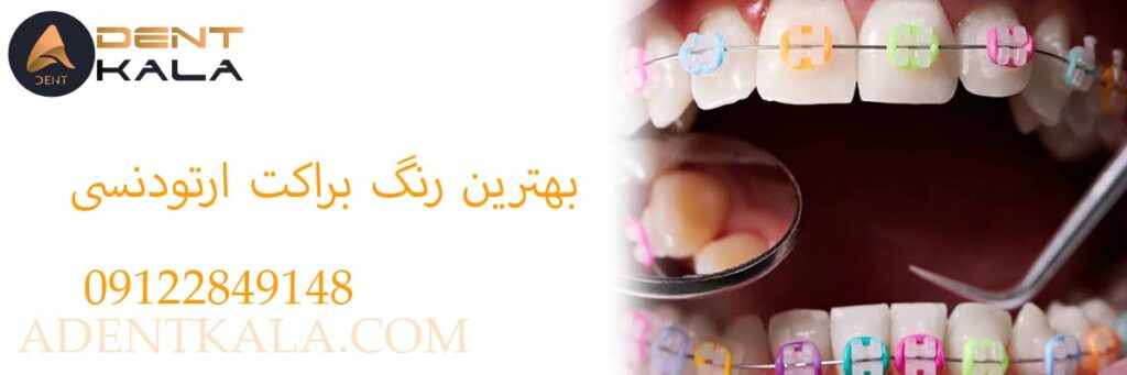 بهترین رنگ براکت ارتودنسی