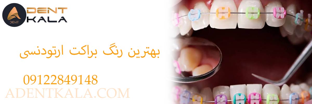 بهترین رنگ براکت ارتودنسی