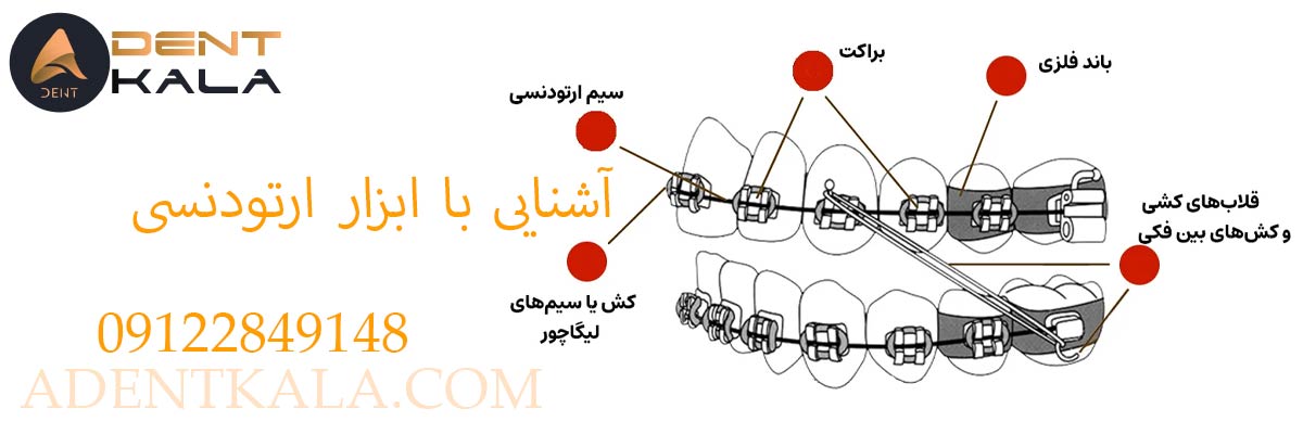 آشنایی با ابزار ارتودنسی