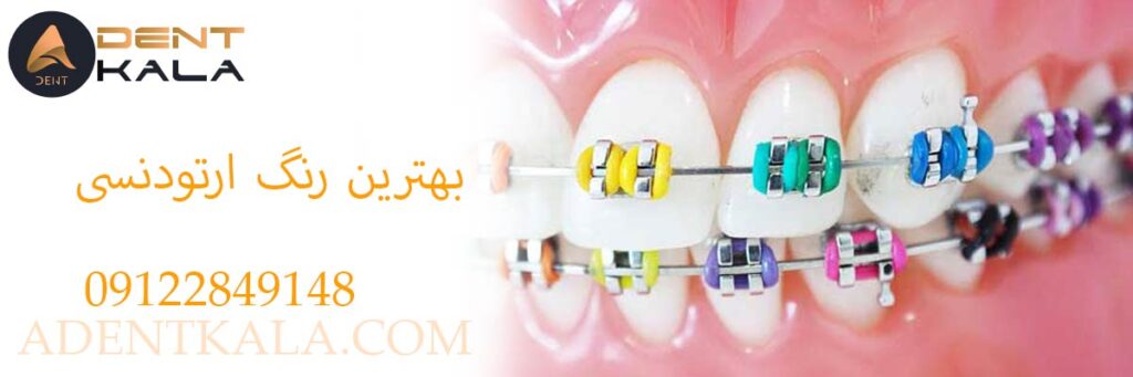 بهترین رنگ ارتودنسی