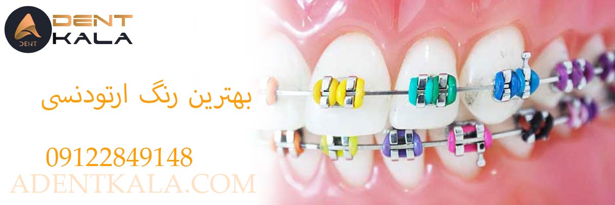 بهترین رنگ ارتودنسی