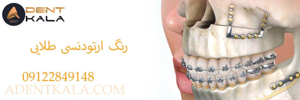 قیمت فک بند ارتودنسی