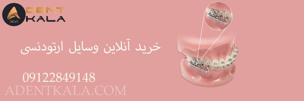 خرید آنلاین وسایل ارتودنسی