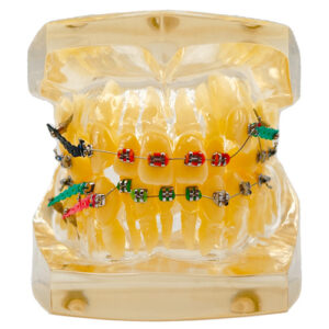 مولاژ دندان ارتودنسی | Dental mollage